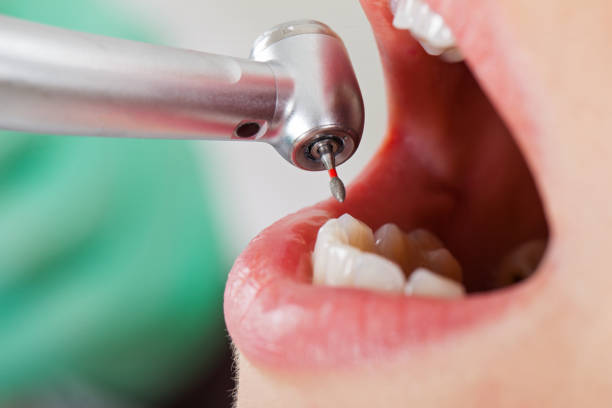 Best Emergency Gum Pain Relief  in Twin Lakes, CA